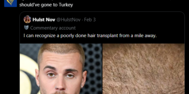 ryanairden-justin-bieberin-saclarina-yorum-turkiyeye-gitmeliydi-eZUGh7cM.png