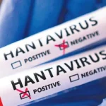 dunyada-hantavirus-alarmi-1778349384900.jpeg