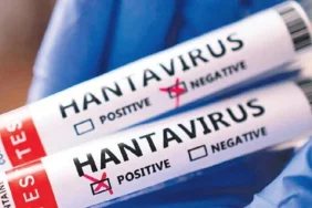 dunyada-hantavirus-alarmi-1778349384900.jpeg