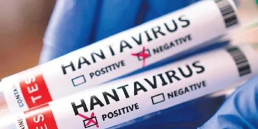 dunyada-hantavirus-alarmi-1778349384900.jpeg