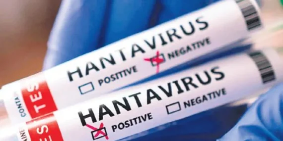 dunyada-hantavirus-alarmi-1778349384900.jpeg