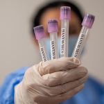 hantavirus-icin-onayli-te-610_2-41.jpg