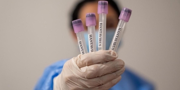 hantavirus-icin-onayli-te-610_2-41.jpg
