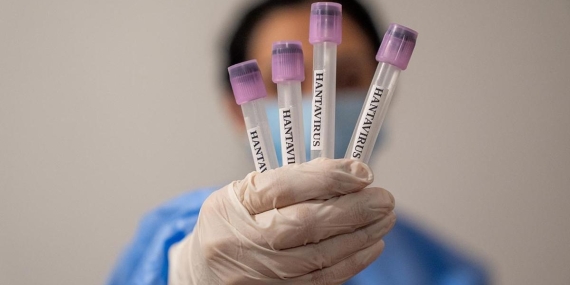 hantavirus-icin-onayli-te-610_2-41.jpg