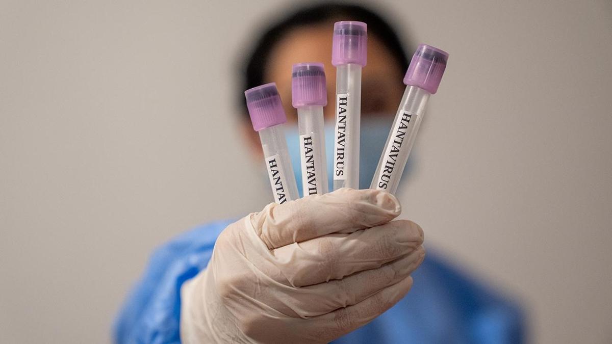 hantavirus-icin-onayli-te-610_2-41.jpg